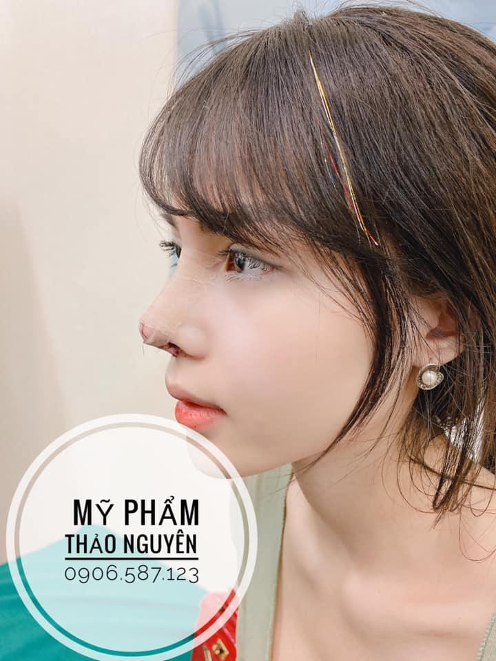 Thảo Nguyên Beauty Center