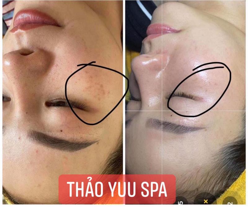 Thảo Yuu beauty & spa