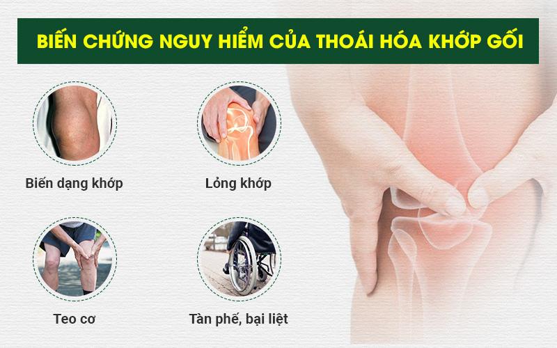 Biến chứng nguy hiểm của thoái hóa khớp gối