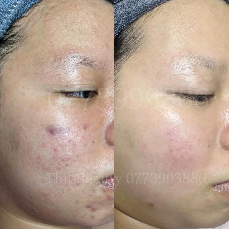 Thu Beauty - Spa & Clinic