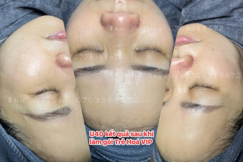 Thu Beauty - Spa & Clinic