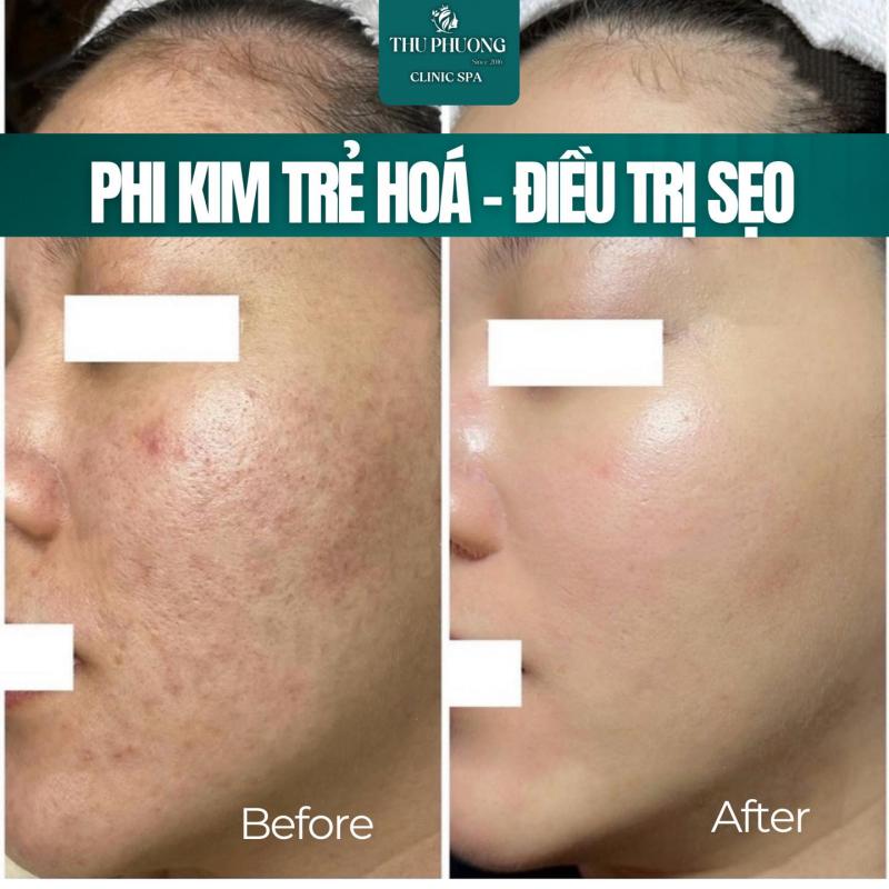 Thu Phuong Clinic Spa