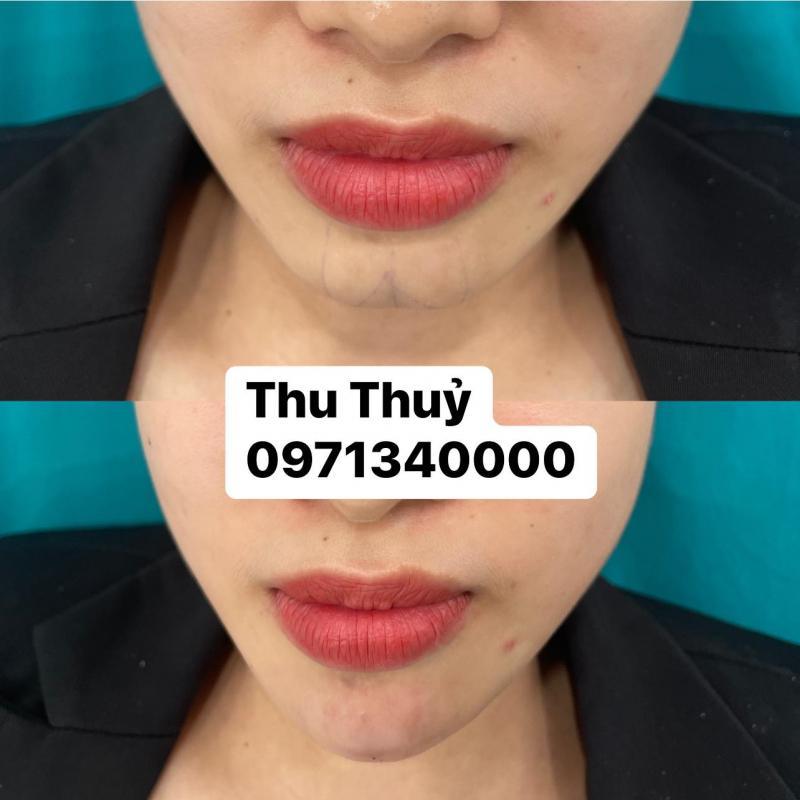 Thu Thuỷ Beauty & Spa