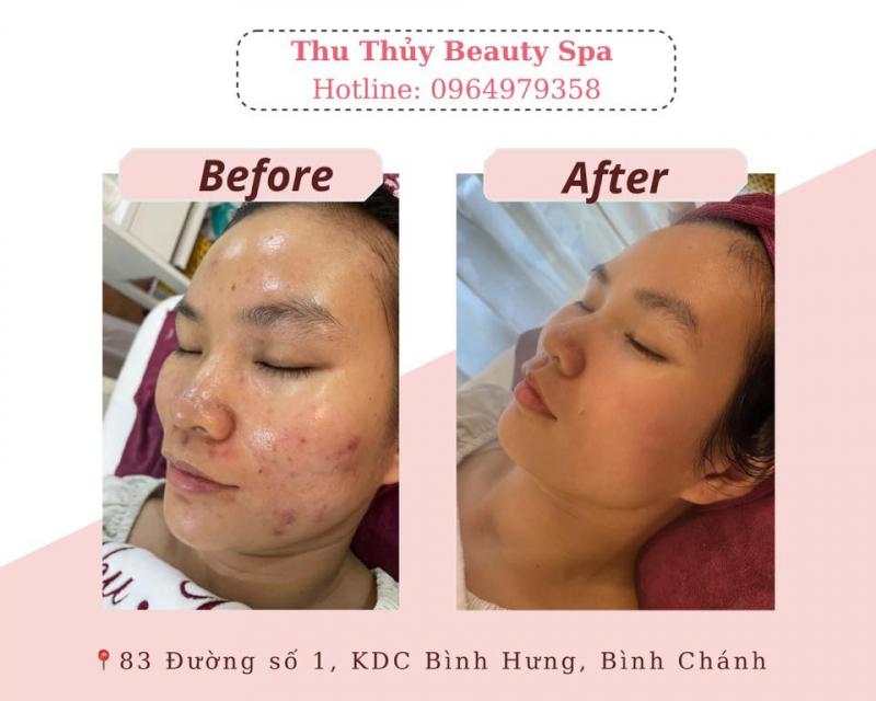 Thu Thủy Beauty Spa