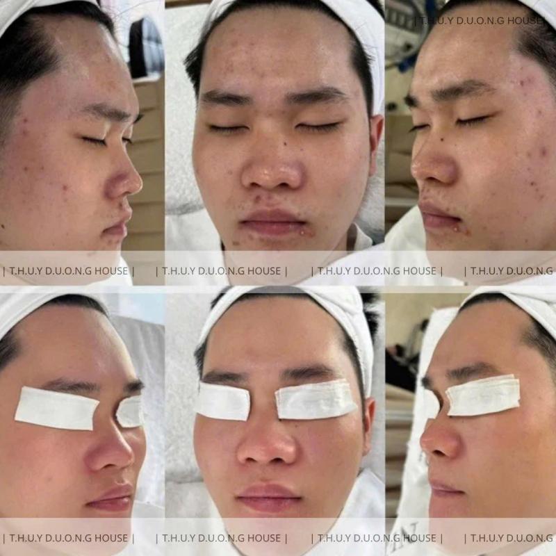 Thùy Dương House - Spa Biên Hòa chuyên điều trị Mụn, Nám, Rỗ