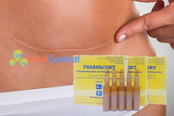 Tiêm sẹo Pharmacort