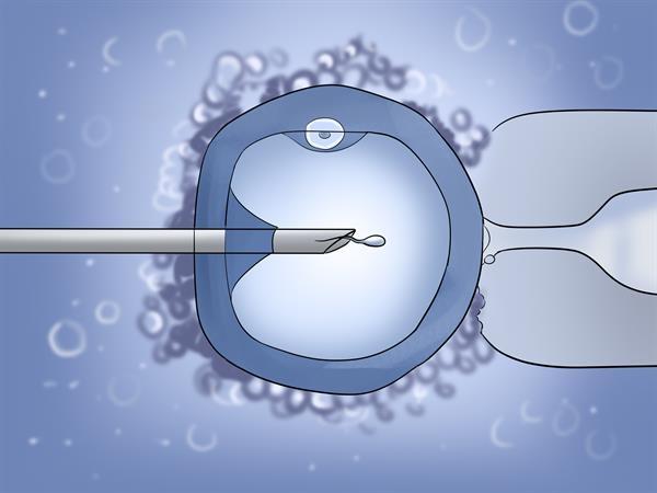 Tiêm tinh trùng vào bào tương trứng