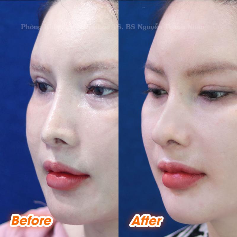 Tiến sĩ – Bác sĩ Nguyễn Thành Nhân