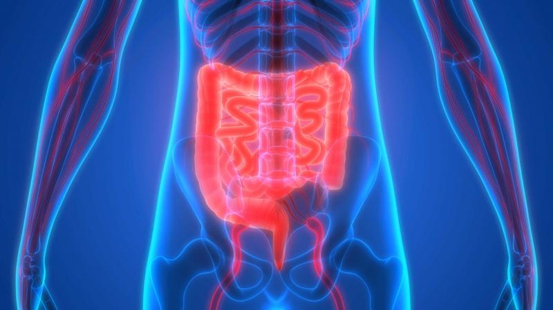 Bệnh crohn làm tăng nguy cơ gây ung thư