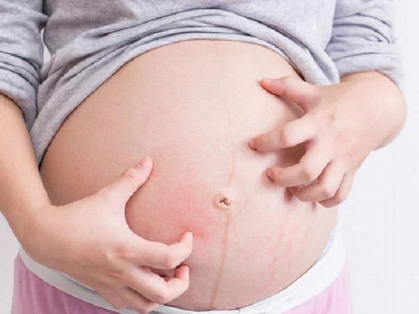 Sau khi sinh em bé, hiện tượng bị ngứa khi mang thai sẽ tự khỏi.