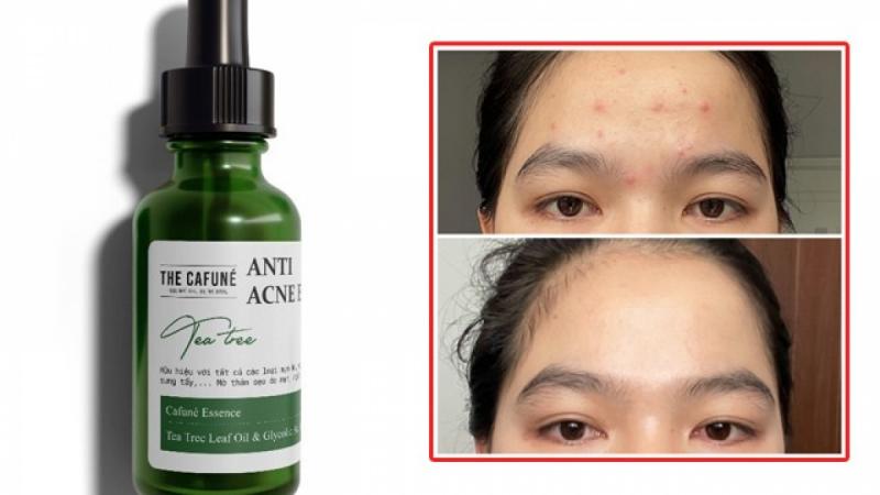 Tinh chất chấm mụn mờ thâm Cafuné Essence