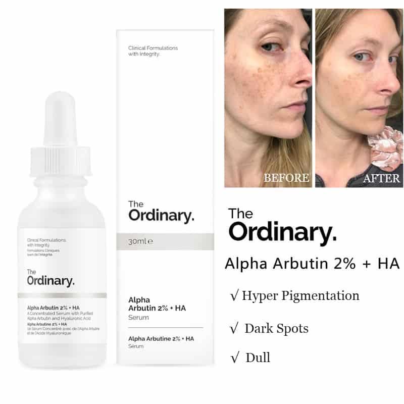 Tinh chất dưỡng trắng mờ thâm nám The Ordinary Alpha Arbutin 2% + HA