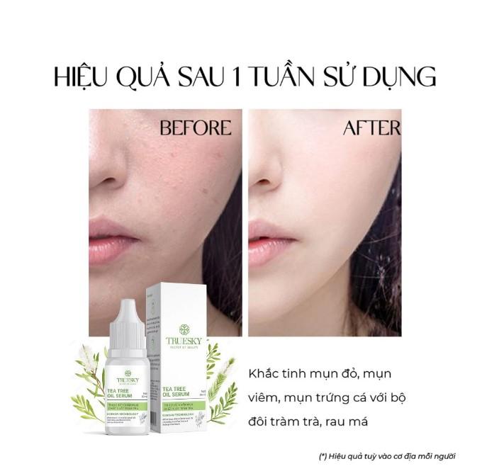 Tinh chất Truesky Tea Tree Oil Serum