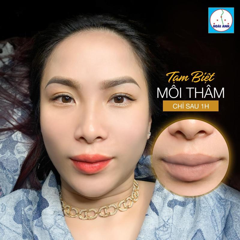 Thẩm mỹ viện Hoài Anh