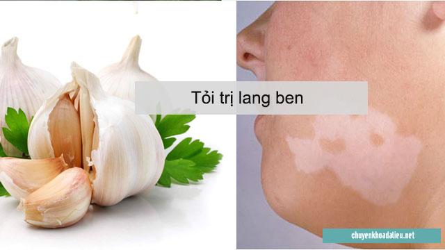 Tỏi có tác dụng giống như một loại thuốc kháng sinh nên việc dùng tỏi trị lang ben sẽ mang lại hiệu quả khá tốt.﻿