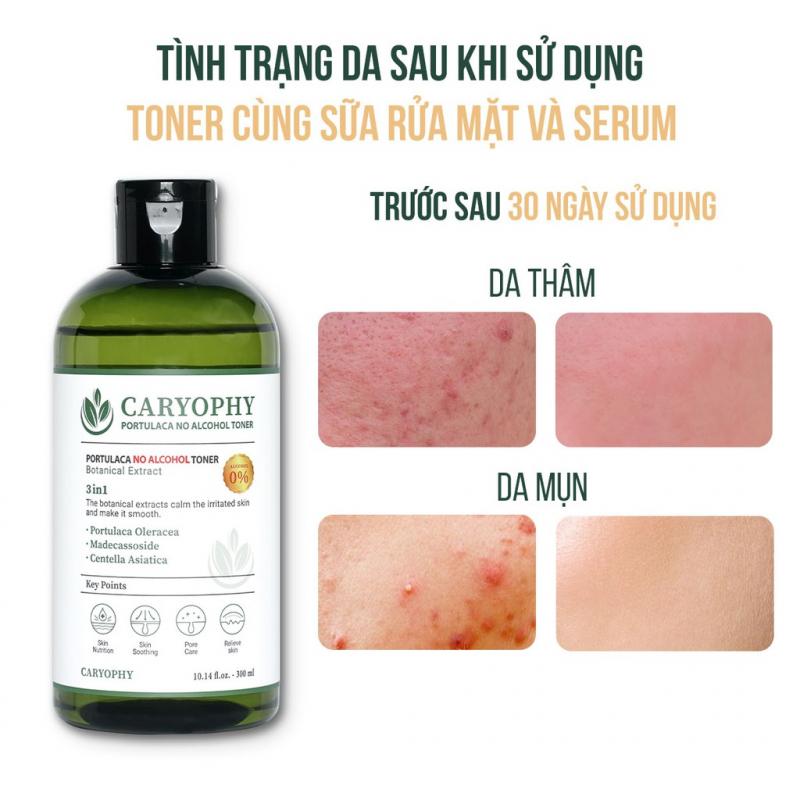 Toner Caryophy Portulaca không cồn Hàn Quốc