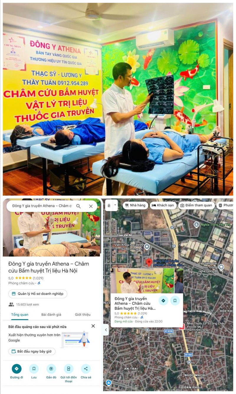 Đặc biệt, cơ sở Đông Y Athena Xuân Phương, Hà Nội đã vinh dự đạt mốc hơn 1.000 lượt đánh giá 5 sao tuyệt đối trên Google Maps từ bệnh nhân thực tế.