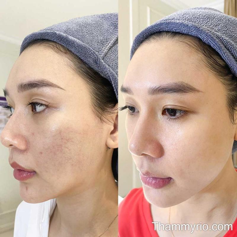 Thẩm mỹ Rio Beauty Clinic