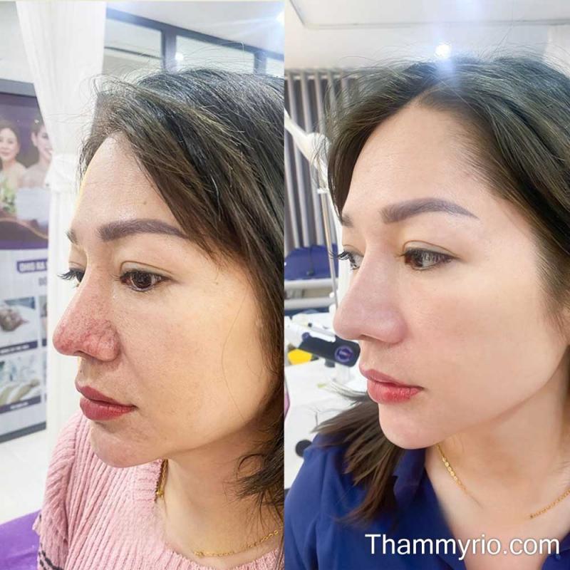 Thẩm mỹ Rio Beauty Clinic