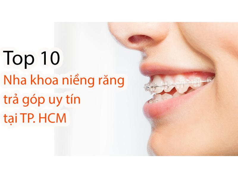 Top 10 nha khoa niềng răng trả góp uy tín nhất TP. HCM