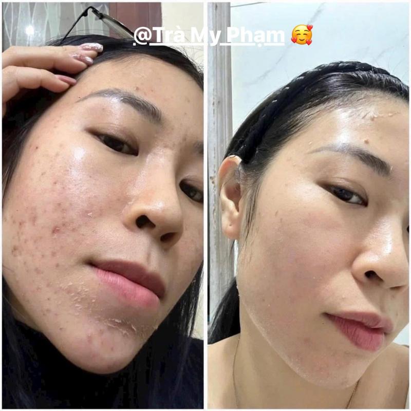 Trà My - Beauty Clinic Spa