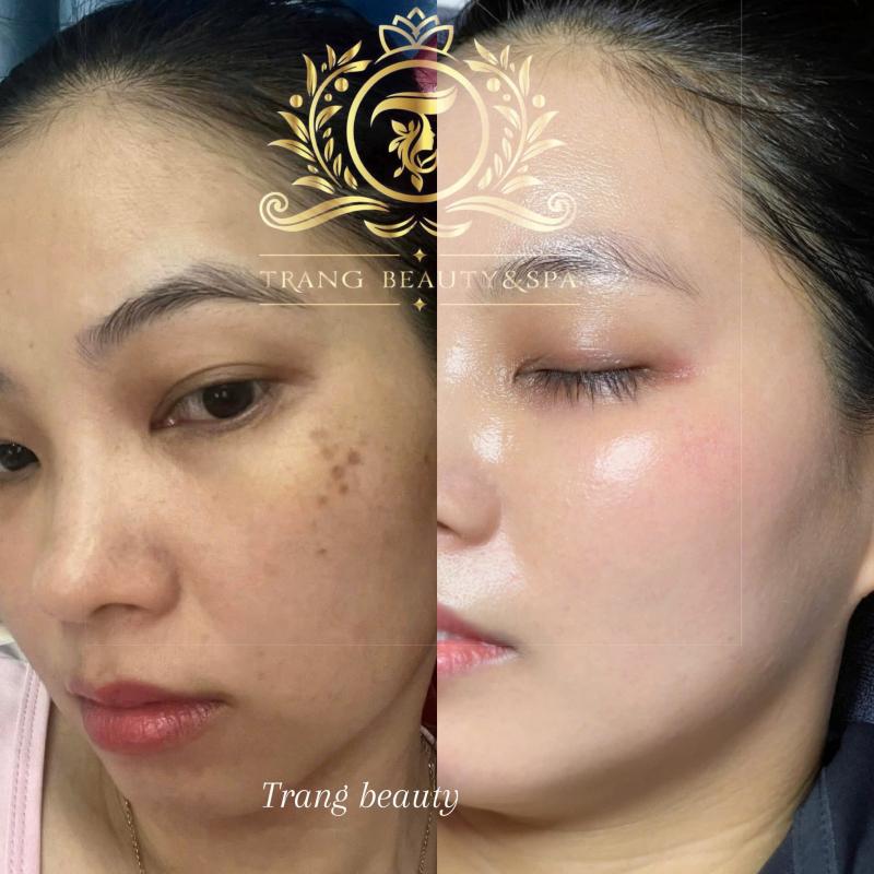 Trang Beauty & Spa