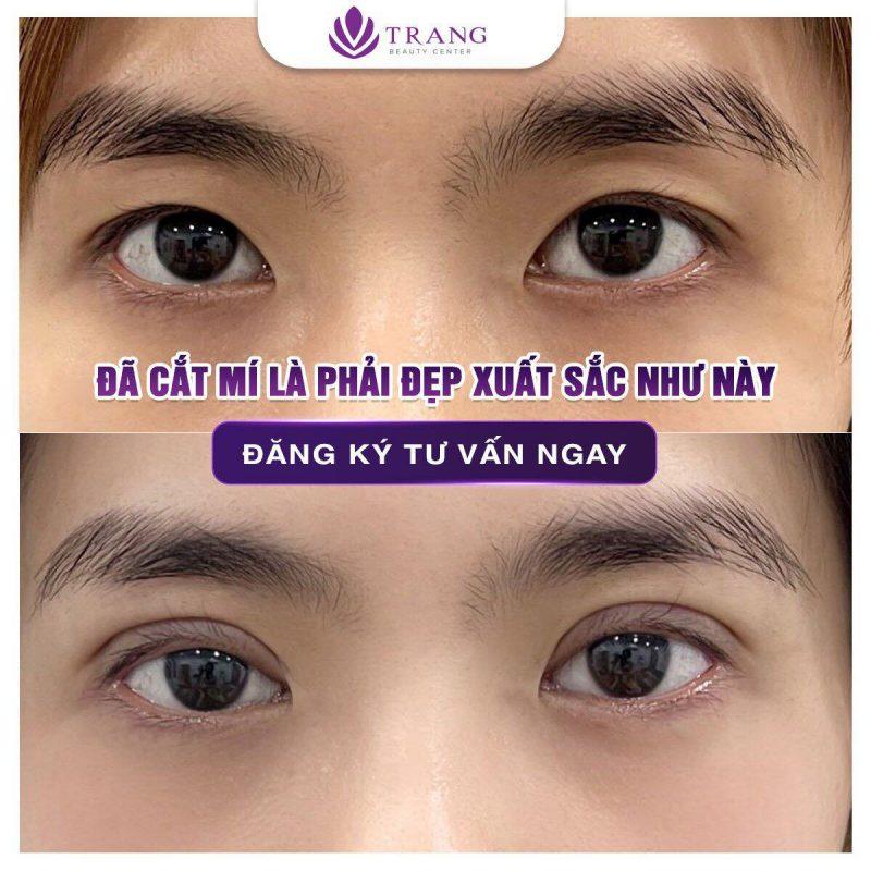 Trang Beauty Center