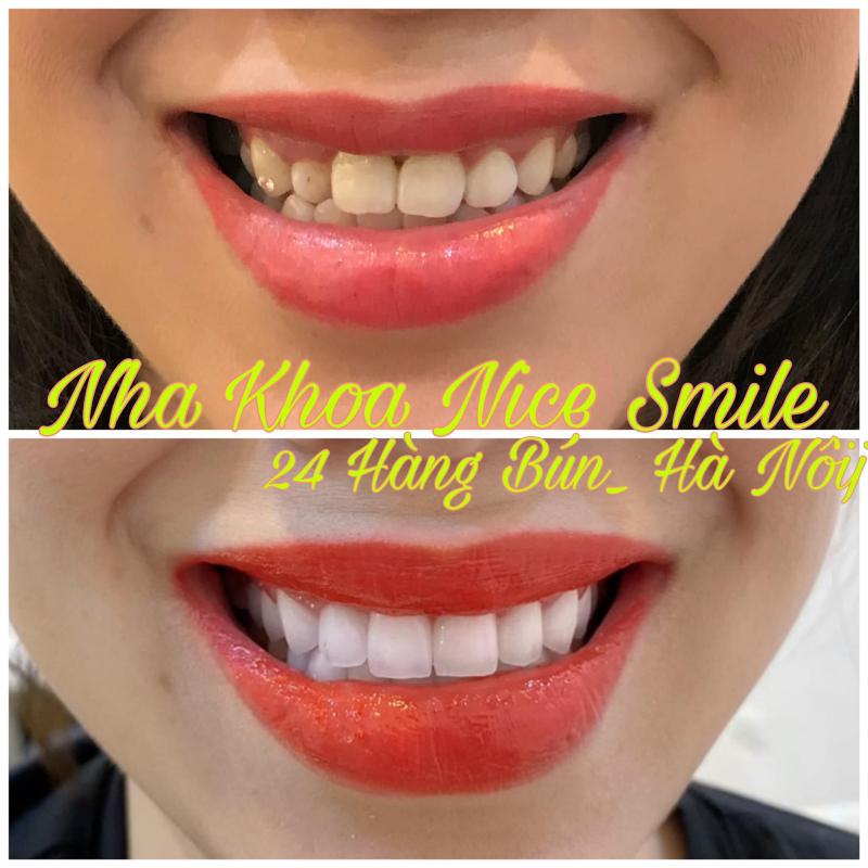 Trang Dentist - Nha Khoa Thẩm Mỹ Nice Smile