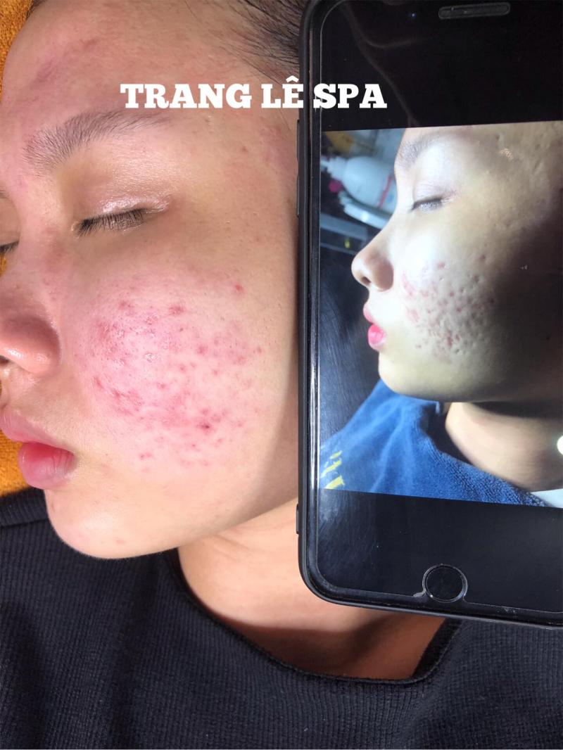 Trang Lê Spa