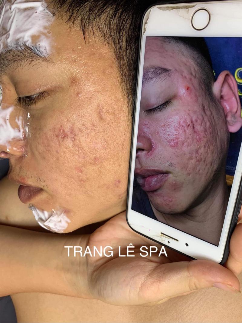 Trang Lê Spa