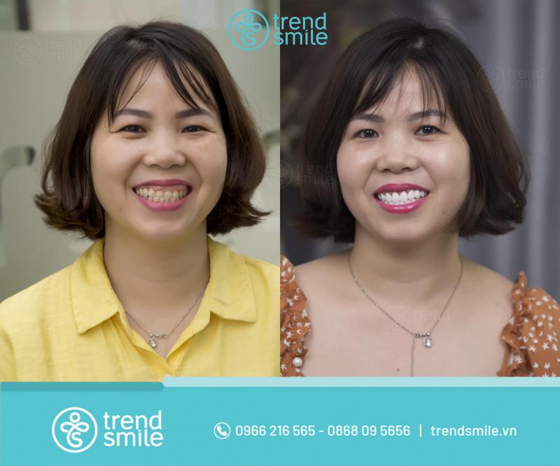 Trend Smile Dental