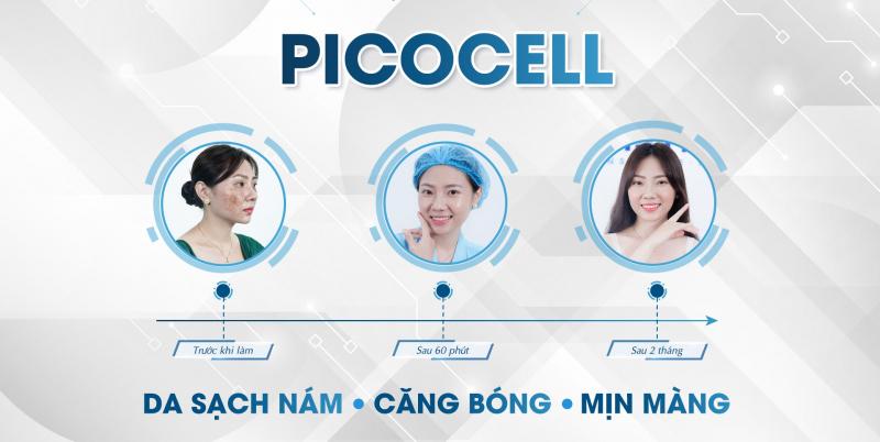 Trị nám tàn nhang với thế hệ công nghệ mới Picocell