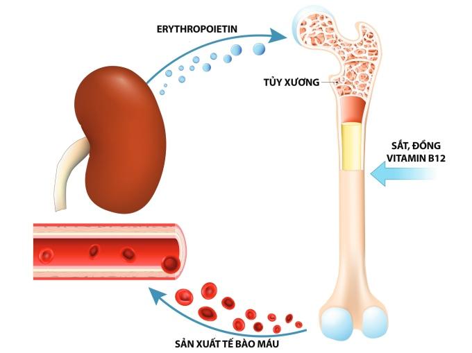 Thận giảm tiết Erythropoietin gây thiếu máu