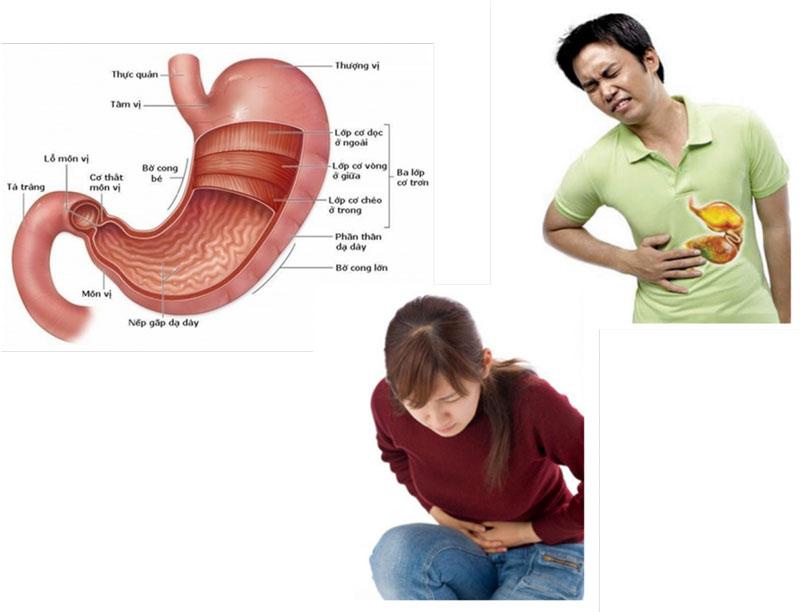 Triệu chứng của viêm hang vị dạ dày