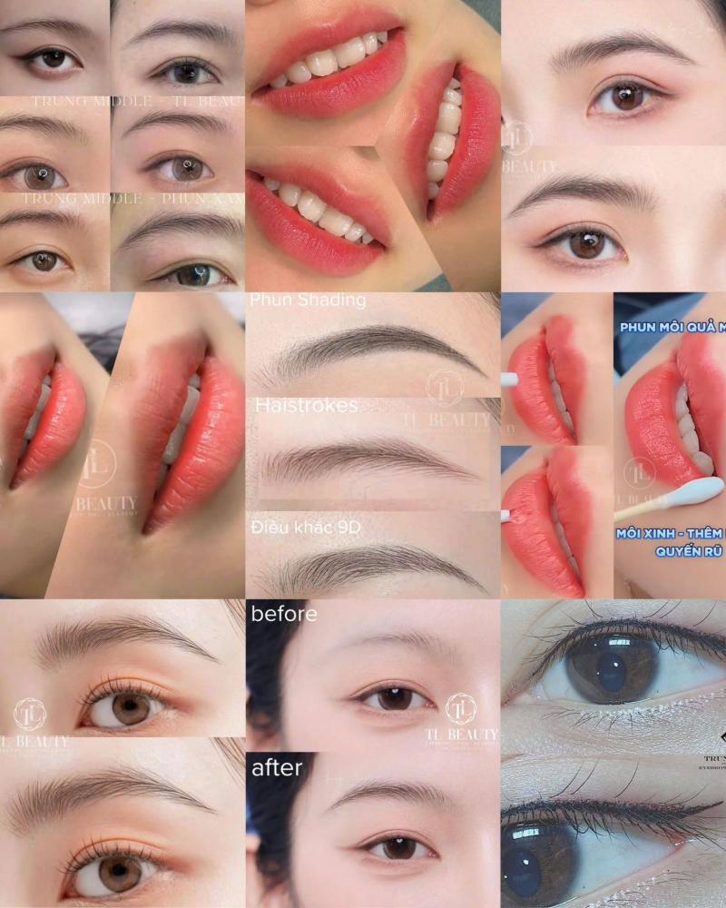 Trung Middle - TL Beauty Center