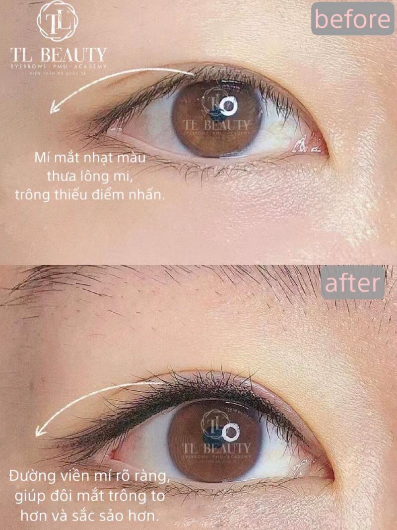 Trung Middle - TL Beauty Center