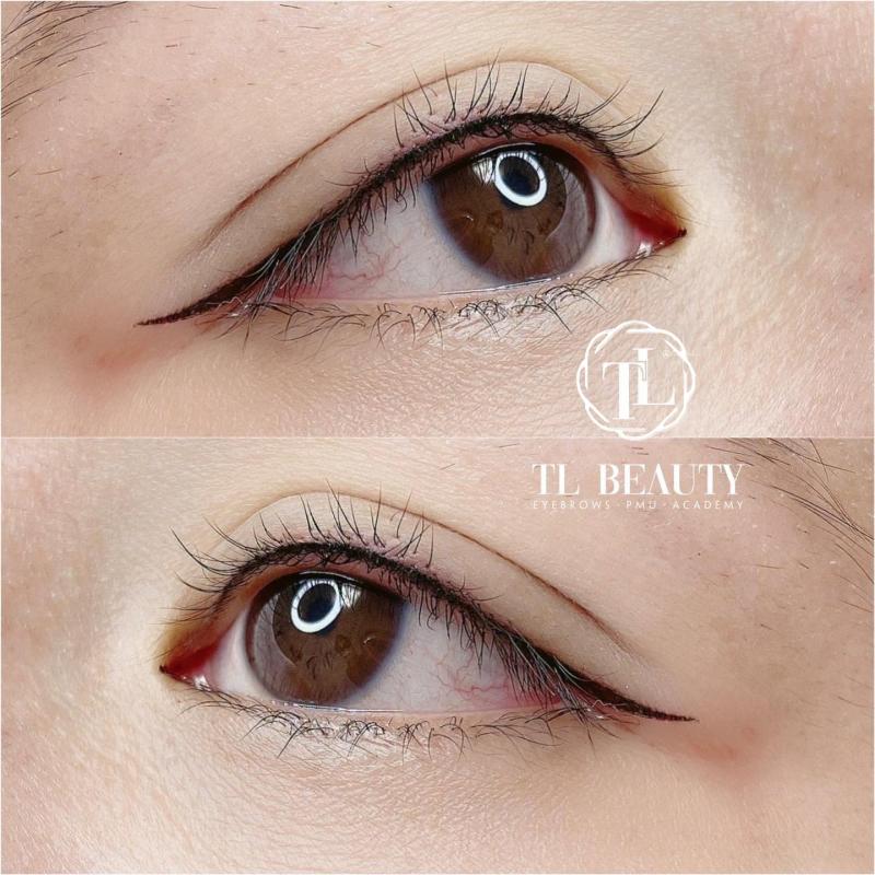 Trung Middle - TL Beauty Center