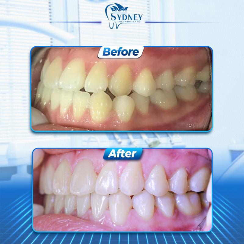 Trung Tâm Nha khoa Hanoi Sydney