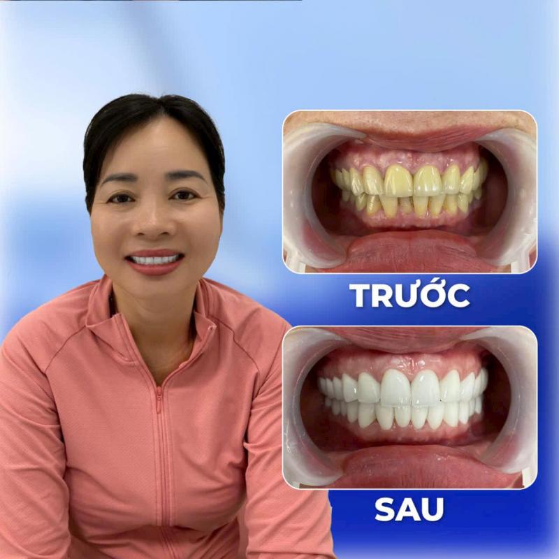 Trung Tâm Nha Khoa Quốc Tế Hoàn Mỹ