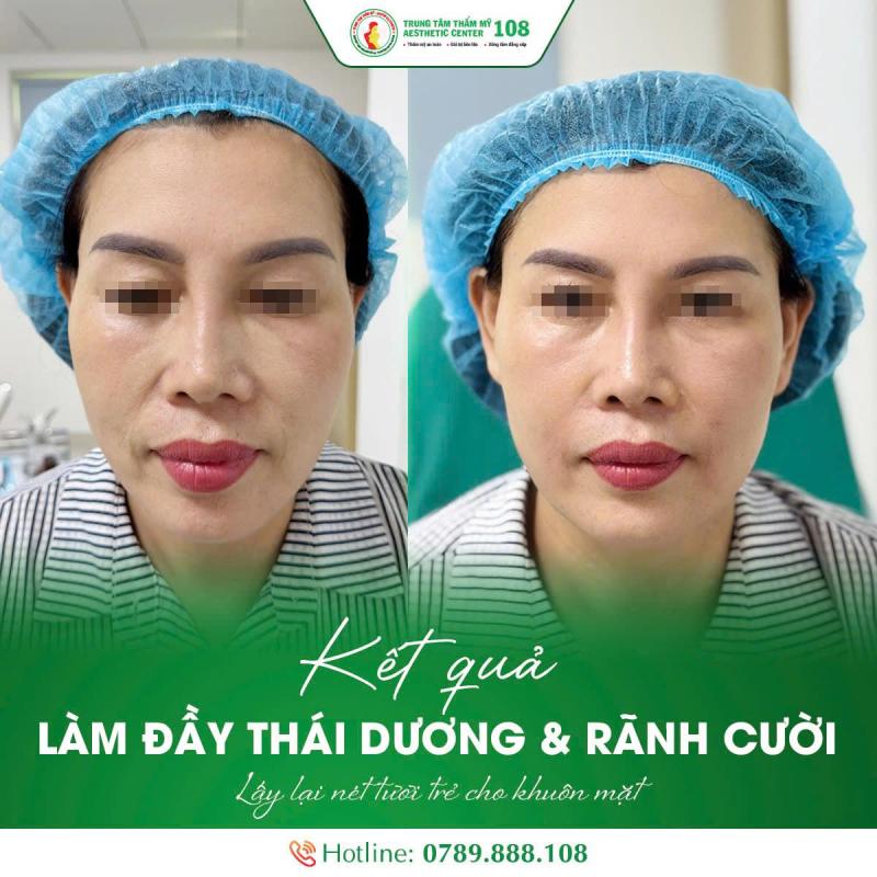 Trung tâm Thẩm mỹ - Bệnh viện TWQĐ 108