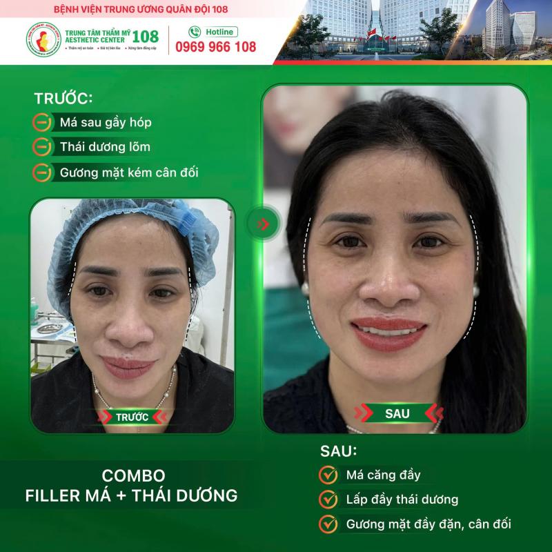 Trung tâm Thẩm mỹ - Bệnh viện TWQĐ 108