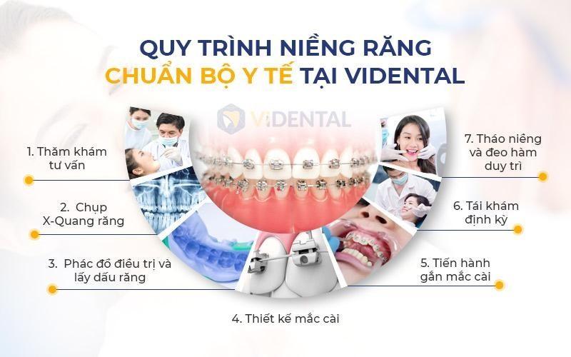 Trung Tâm ViDental Brace