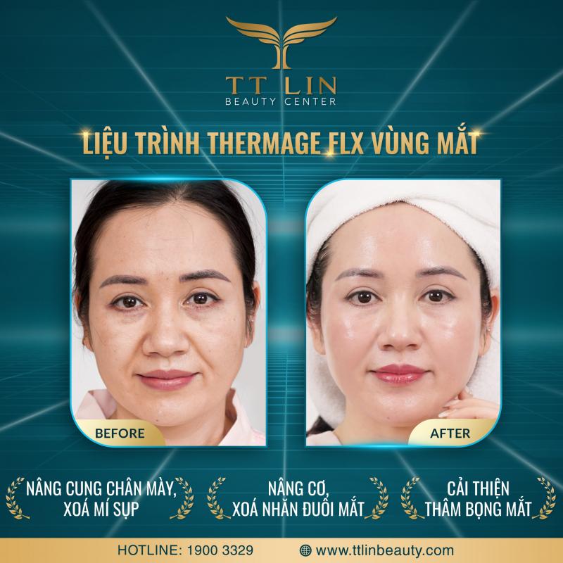 TT Lin Beauty Quảng Bình