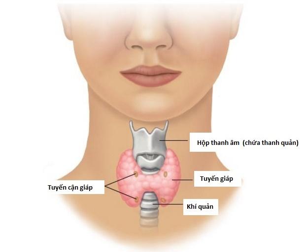 U tuyến giáp gây khó chịu cho cuộc sống người bệnh