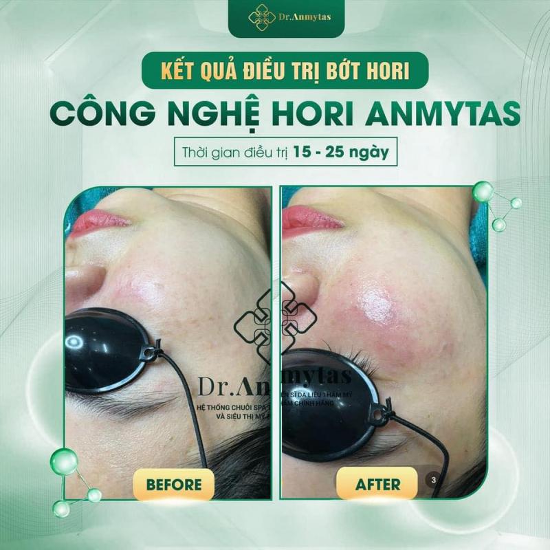 Uma Spa- Chuẩn y khoa