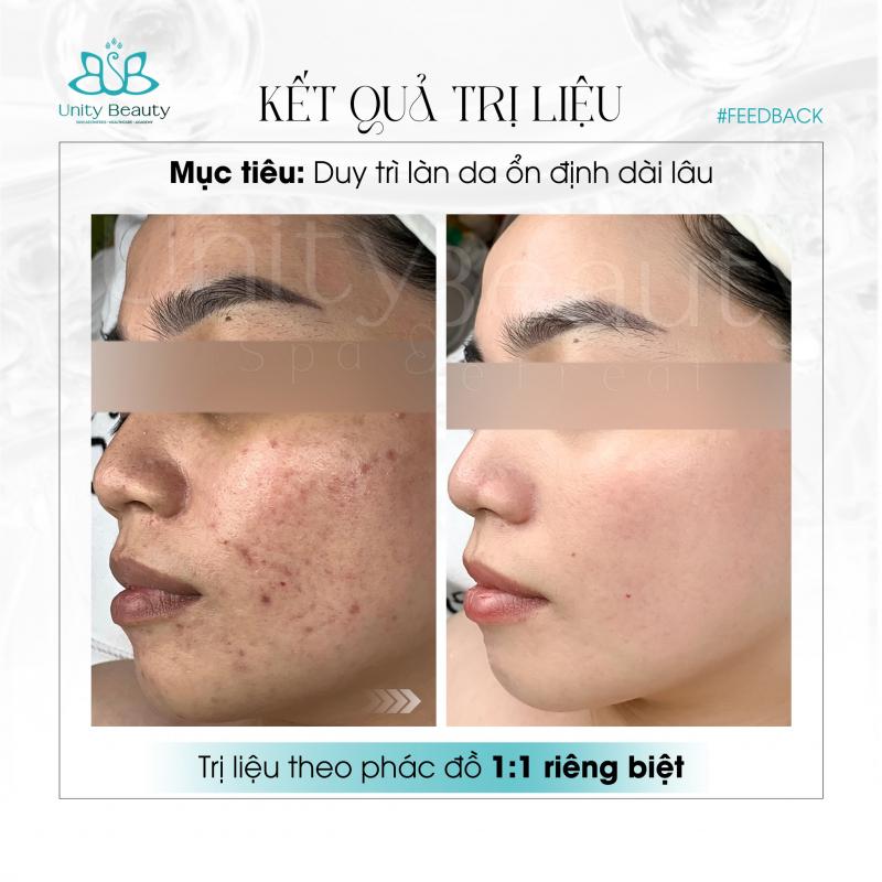Unity Beauty Cần Thơ - Spa làm đẹp chuẩn Y Khoa