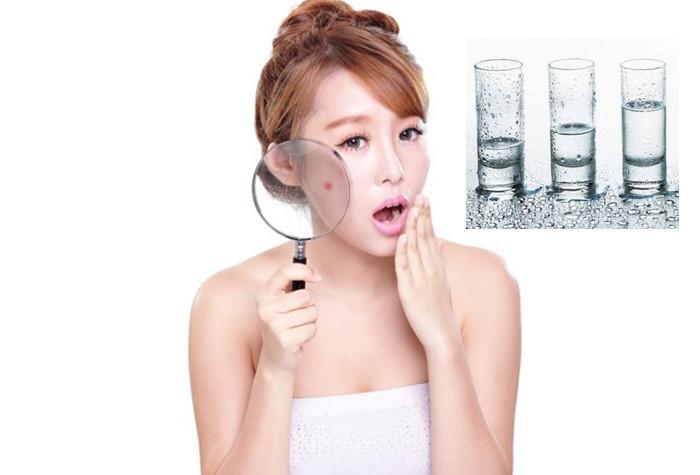 Uống đủ 2 lít nước mỗi ngày đã cải thiện đáng kể quá trình hydrate hóa da, giảm tình trạng da khô ráp kèm đổ dầu và giảm mụn