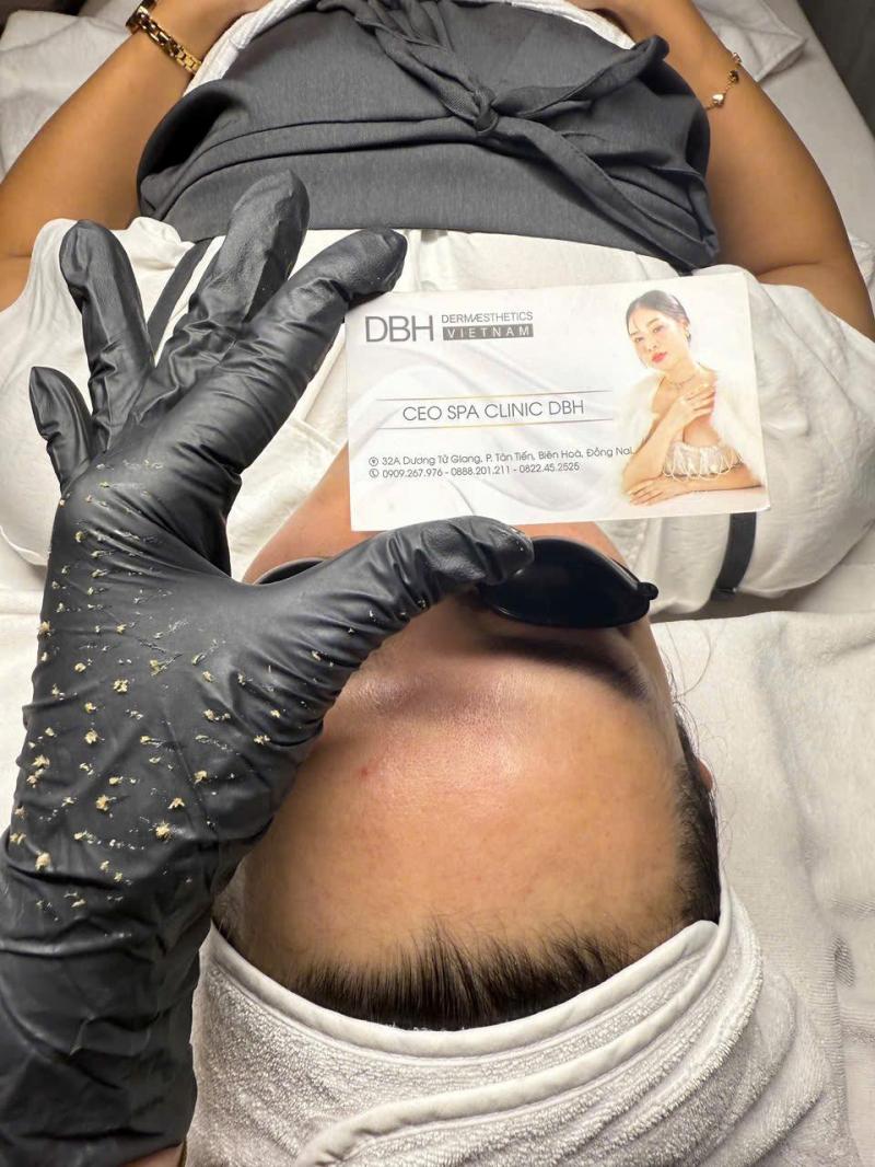 Uyên Spa - Chuyên Gia Trị Mụn Hàng Đầu Đồng Nai