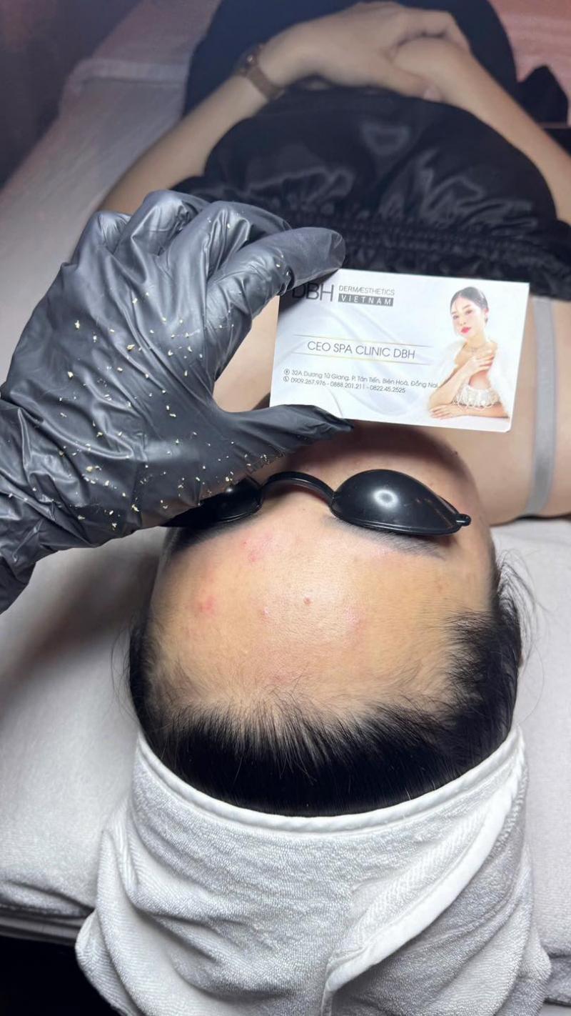 Uyên Spa - Chuyên Gia Trị Mụn Hàng Đầu Đồng Nai