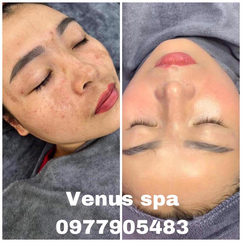 VENUS Spa - Bắc Ninh